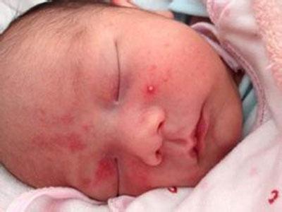 夏天如何避免兒童甲醛中毒？用對方法治理甲醛，讓孩子遠離白血?。?/></p><p style=